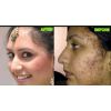 Skin whitening and lightening products +27739970300 answarsadat,